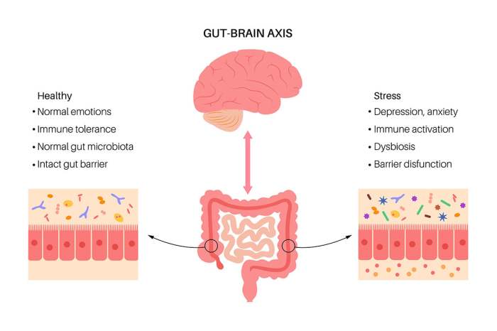 The Gut-Brain Connection: How a Healthy Gut Supports Emotional and ...